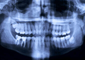 Dental Radyoloji